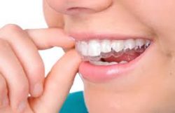 Orthodontist For Adults Near Me