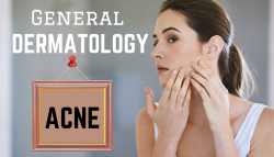 Acne Skin Care Treatment