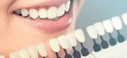 Cosmetic Dentistry Treatments