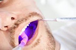 Effect Laser Treatment for Your Gum Problems