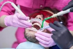 How Much Does A Root Canal Cost?