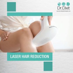Laser Hair Removal Treatment in Bangalore