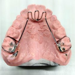 Laboratorio de ortodoncia Úbeda
