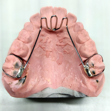 Laboratorio de ortodoncia Úbeda