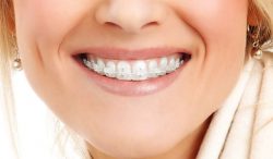 Sapphire Dentistry In Houston Heights