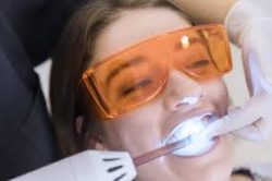 Things You Should Know About Laser Dentistry