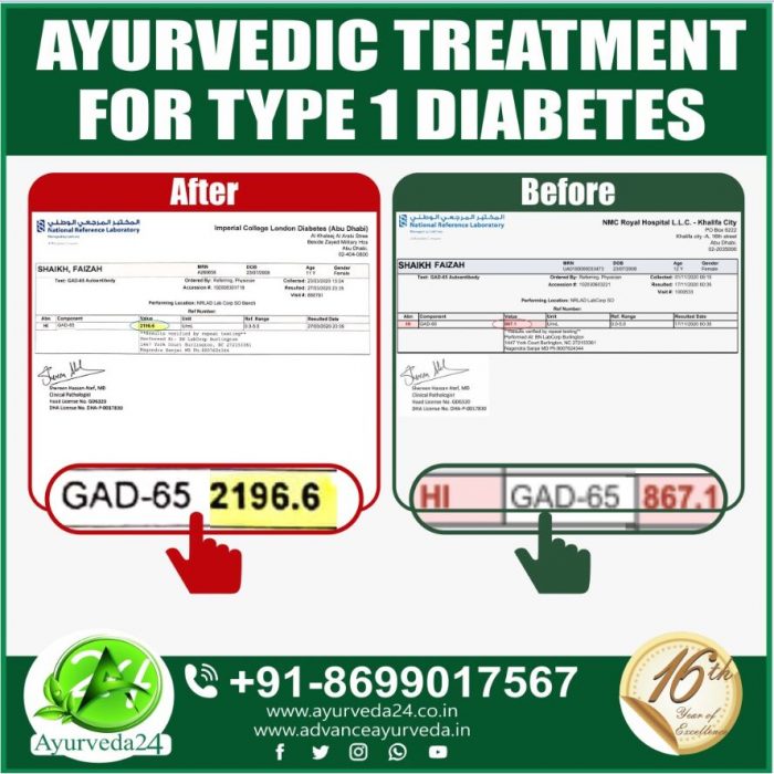 Ayurveda Treatment for Type 1 Diabetes