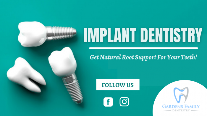 Advanced Dental Implant Technology