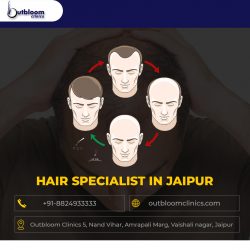 Are you looking hair specialist in Jaipur for hair loss treatment? – Outbloom Clinics