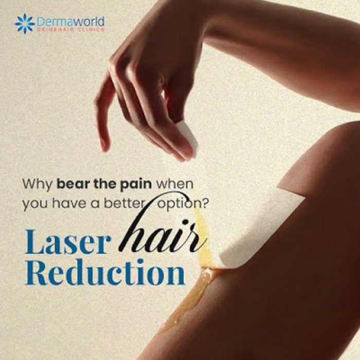 Laser hair removal treatment in Delhi