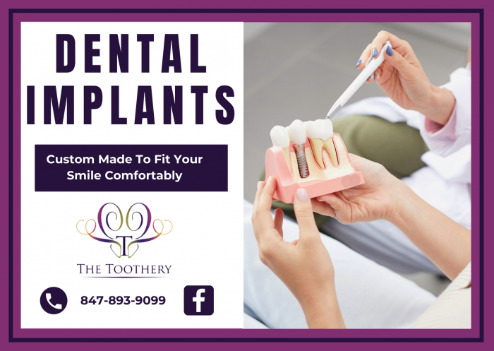 Straighten Your Teeth With Perfect Services