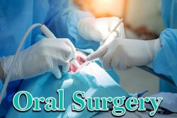 Oral Surgery Procedures