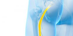 Are There Effective Treatments for Sciatica?
