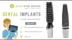 Dental Implants for an Enhanced Smile
