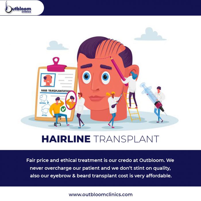 Are you finding Hairline Transplant in Jaipur? -Outbloom Clinics