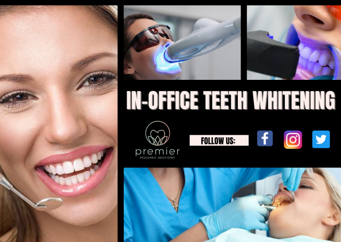 Perfect Whitening Treatment With Optimal Care
