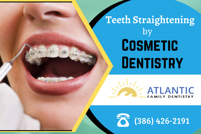 Achieve an Attractive Smile with Teeth Straightening Treatments