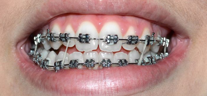 Orthodontic Options Aventura