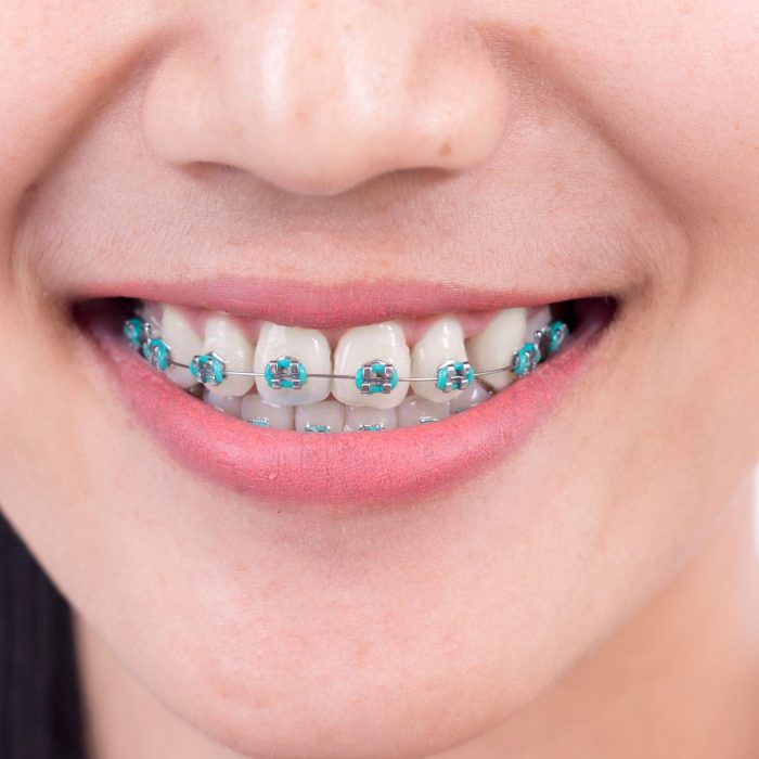 Your Best Rated Orthodontist Near Me in Maimi for Great Health