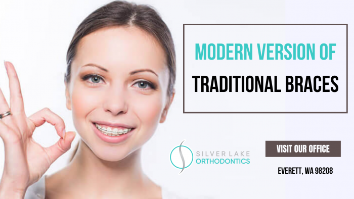 Modern Orthodontic Procedures