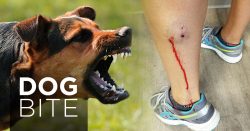 Can I Hire a Personal Injury Lawyer for Dog Injury Bite Claims?