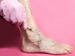 How is vein disease diagnosed?