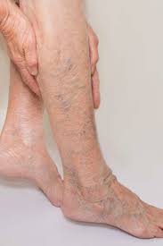 Find a vein treatment clinic in Paramus, NJ, with 5-star ratings and reviews from patients.