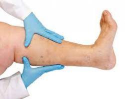 We have the state-of-the-art equipment necessary to make sure you leave the vein clinic feeling  ...