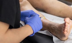 How to Find the Best Vein Center in Long Island?