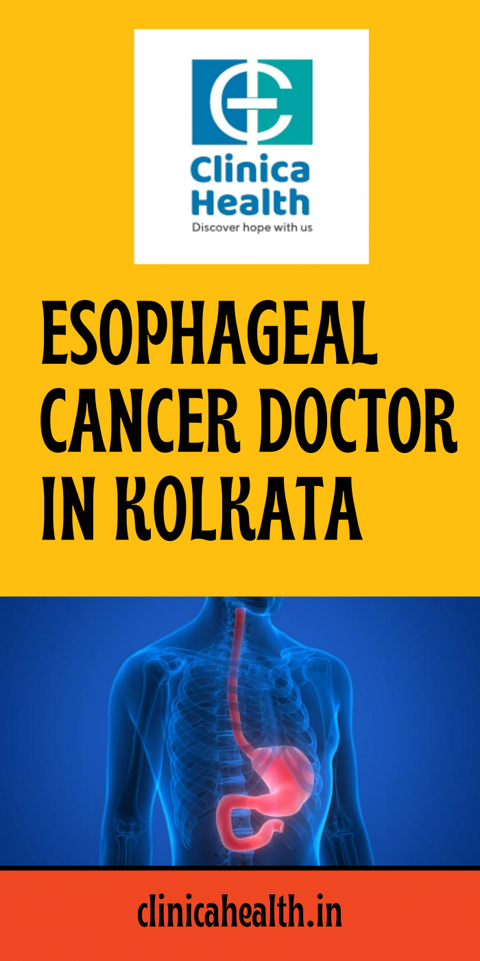 Best Esophagus Cancer Treatment in Kolkata – Clinica Health