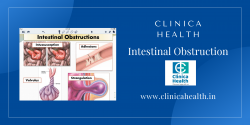 Best Intestinal Obstruction Doctors in kolkata – Cinica Health