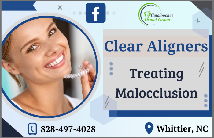 Transparent Aligners for an Aesthetically Pleasing Smile