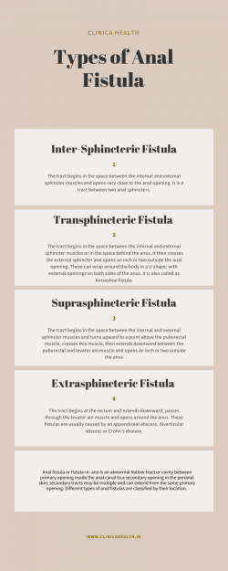 Types Of Anal Fistula – Clinica Health