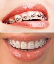Find Best Orthodontists In Miami, Florida