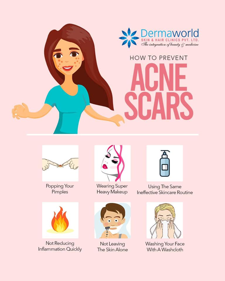 Best acne treatment in delhi