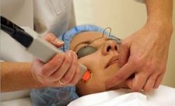 Acne Scar Laser Treatment Cost in Delhi
