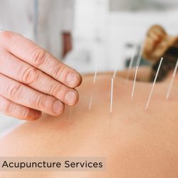 Acupuncture services in Calgary
