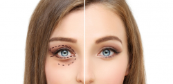 Gregory Casey: Benefits of Eye Cosmetic Surgery