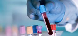Bloodborne Pathogens Training USA