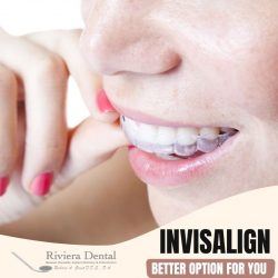 Effective Method of Straightening your Teeth