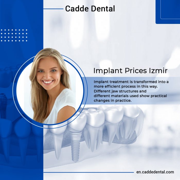 Find Implant Prices Izmir – Cadde Dental