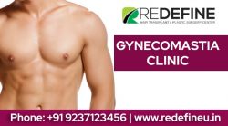 Gynecomastia surgery in Hyderabad
