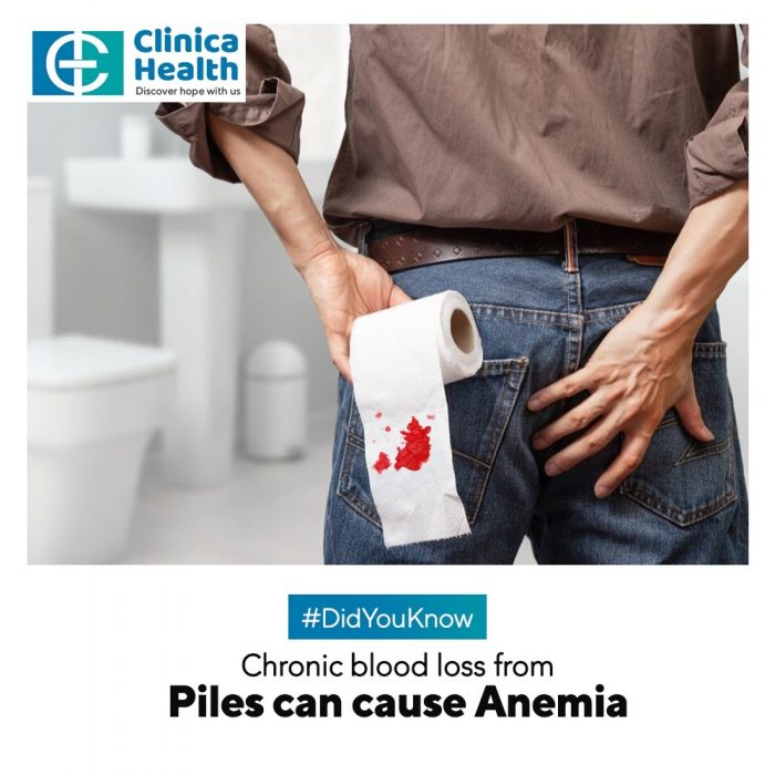 Chronic Blood Loss From Piles Can Cause Anemia