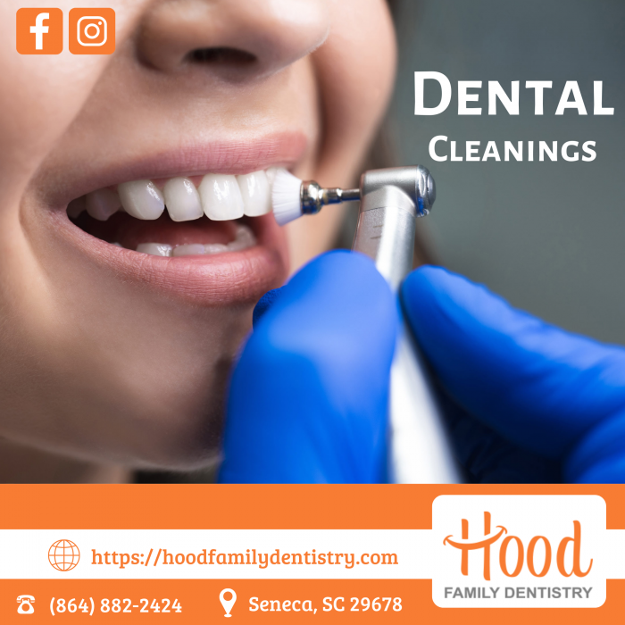 Professional Dental Cleanings