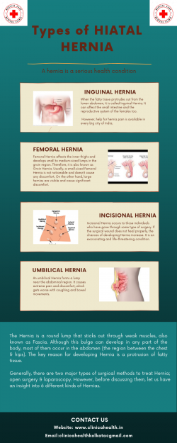 Types of Hiatal Hernia – Clinica Health