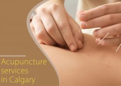 Acupuncture services | Acupuncturists in Calgary
