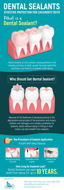 Dental Sealants – Effective Preventive Treatment for Children and Adolescents