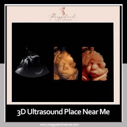 Learn about the 3D Ultrasound Places near you!