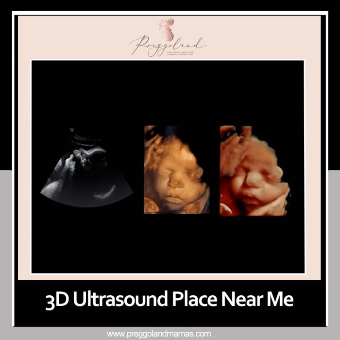 Learn about the 3D Ultrasound Places near you! - Social Social Social ...