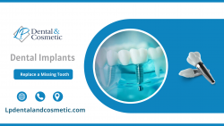 Professional Dentist For Your Healthy Smile